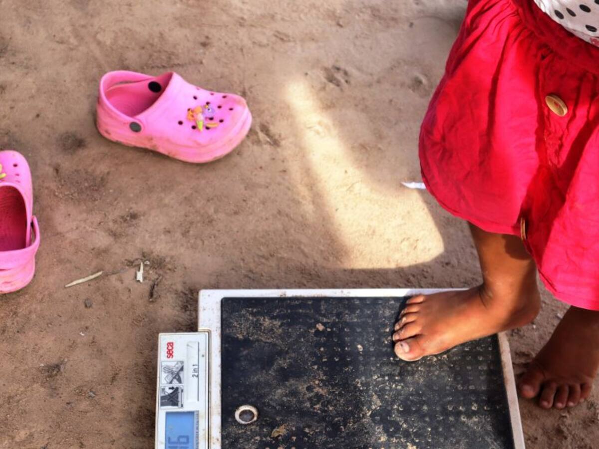 DADIS brinda atención a menores de 5 años con desnutrición en Cartagena