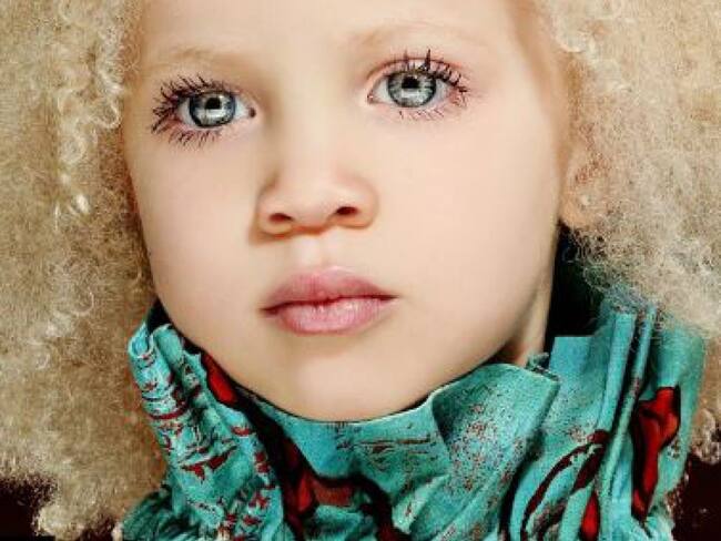 La niña es de ascendencia afroamericana, y desde el momento de su nacimiento ha sorprendido por su belleza exótica.
