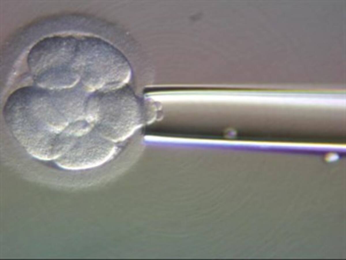 Autorizan la selección genética de embriones para prevenir 2 tipos de cáncer