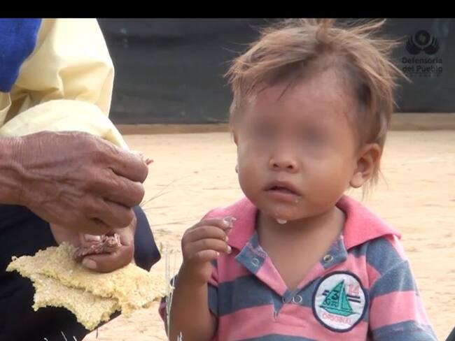 Muere niño por desnutrición en Neiva