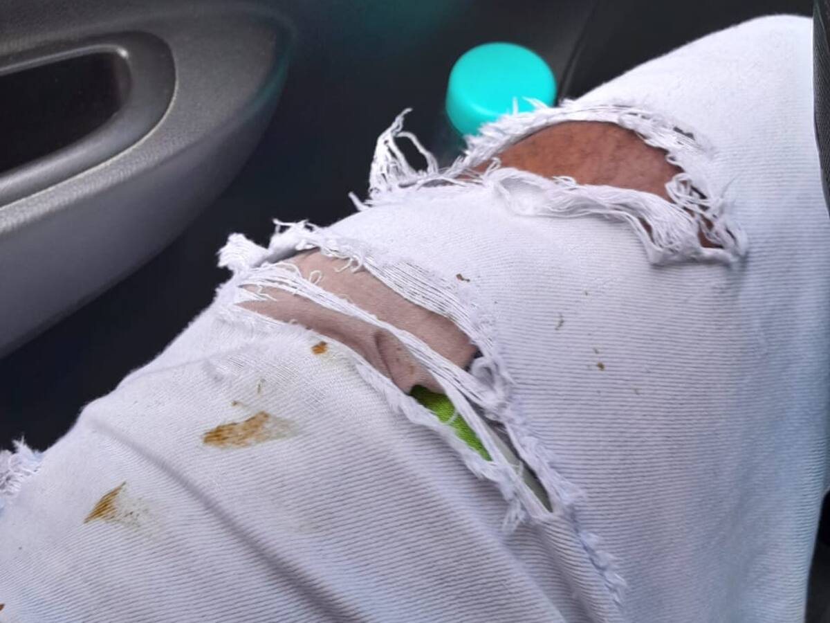 Desde edificio lanzan heces fecales a conductor que descansaba en su carro