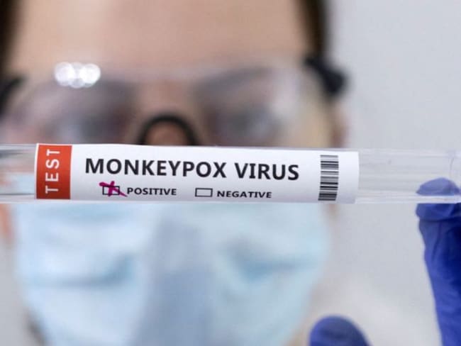 Pruebas de viruela símica.