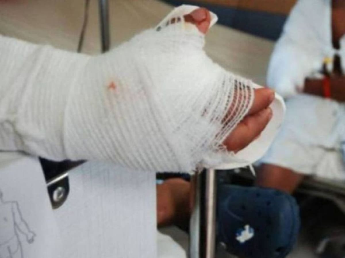 Padres de familia con menores quemados con pólvora serán judicializados