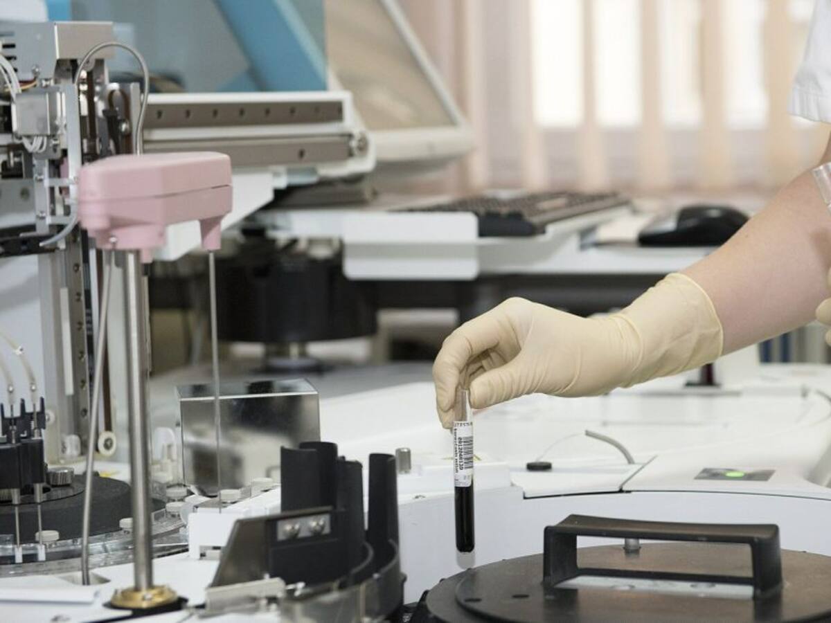 ¿Qué es el cáncer de tiroides?