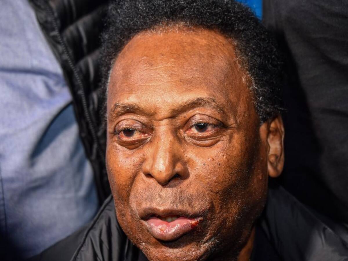 Pelé se recupera satisfactoriamente de una intervención quirúrgica