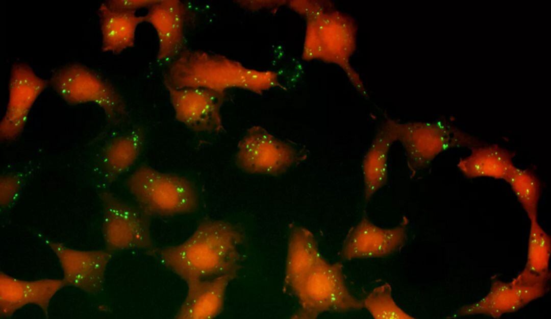 Células cancerígenas