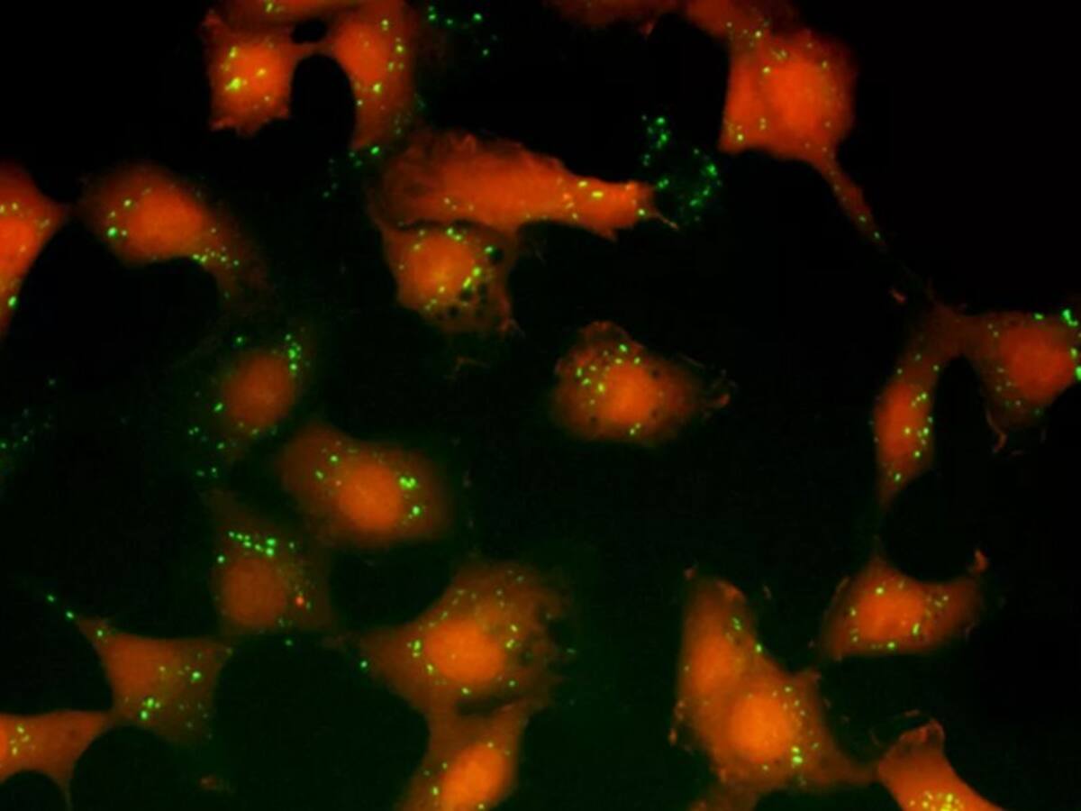 Científicos descubren qué causa el tipo de cáncer más peligroso