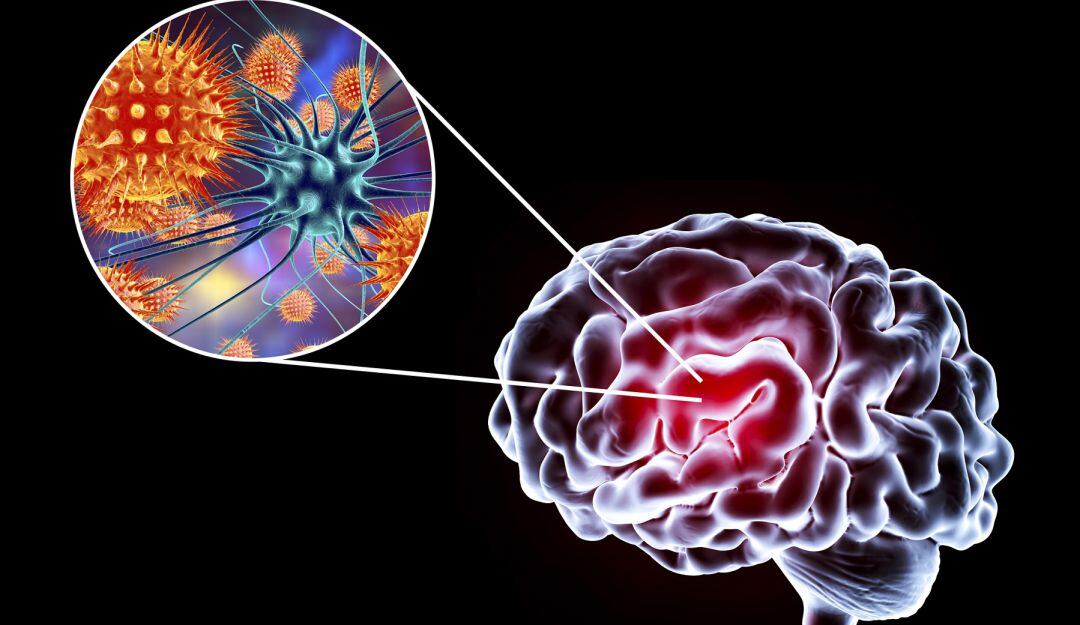 ¿Cuándo se supera la depresión y los transtornos después del COVID-19?