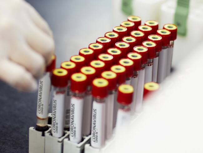 Colombia tiene 37 laboratorios habilitados para diagnóstico de coronavirus