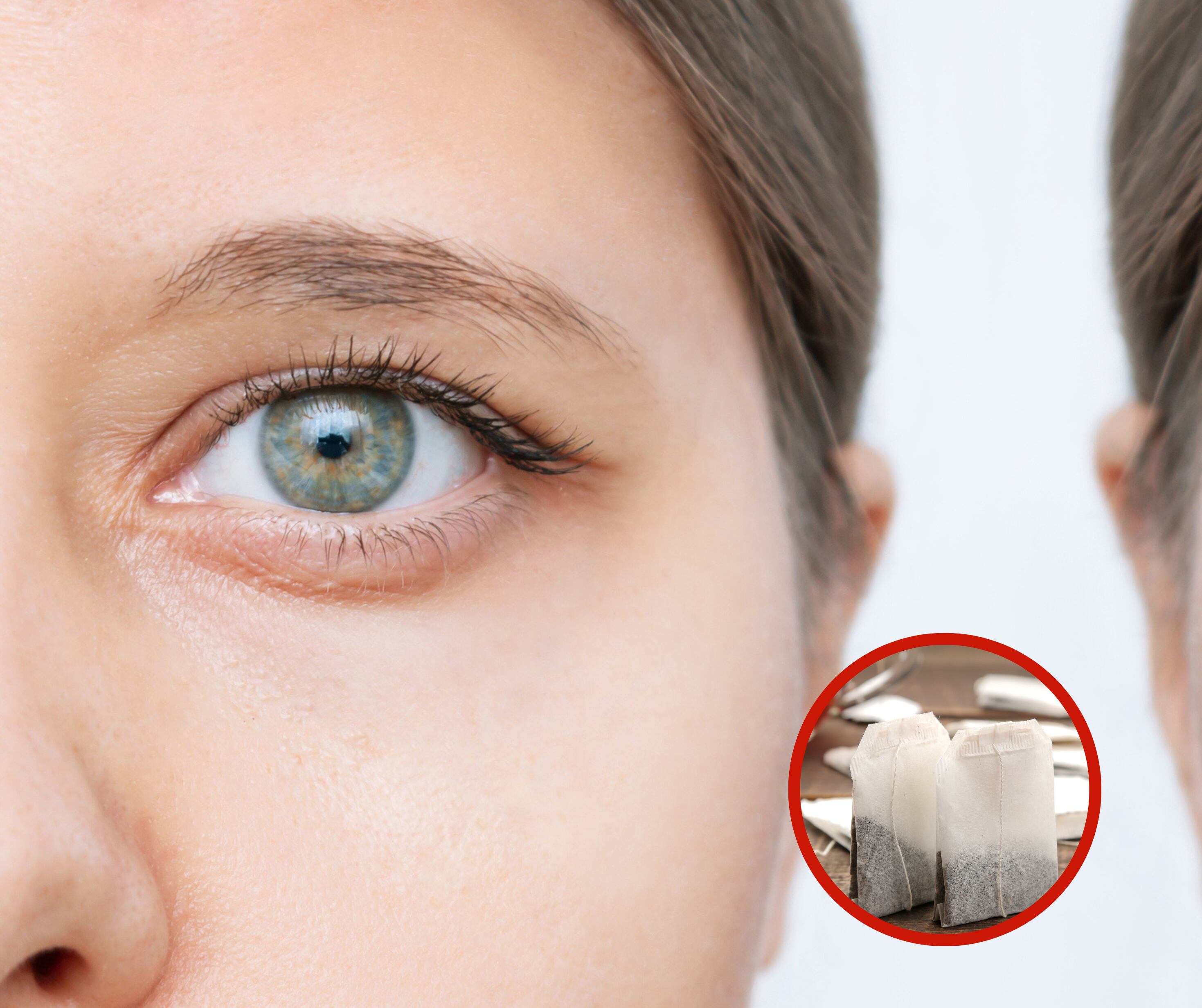 Mujer con el parpado caído junto a una bolsa de té (Getty Images)