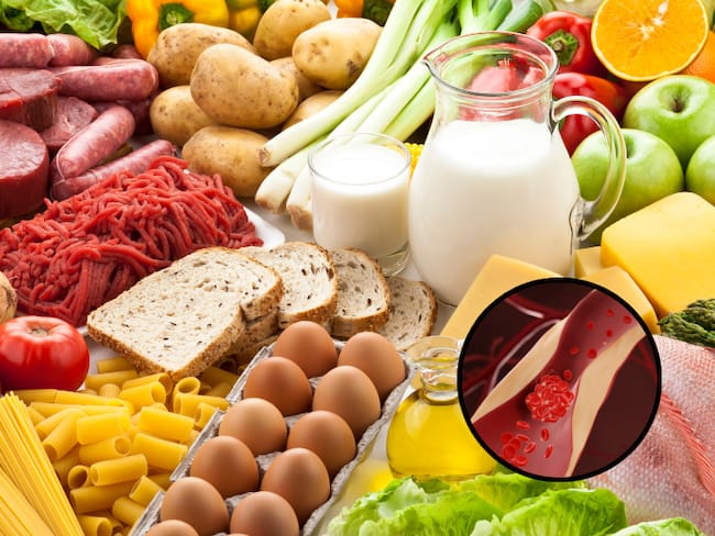 Alimentos de distintas categorías y de fondo una ilustración alusiva a los altos niveles de colesterol (Fotos vía Getty Images)