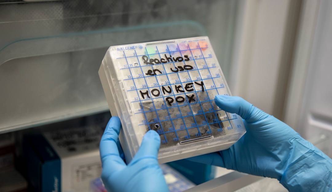 Muestras de la viruela del mono en un laboratorio de Madrid (España).                  Foto: Getty 