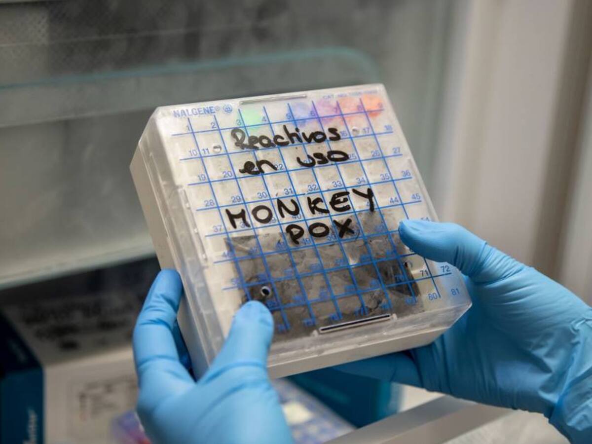 Viruela del mono puede volver a contagiar a quien superó el virus