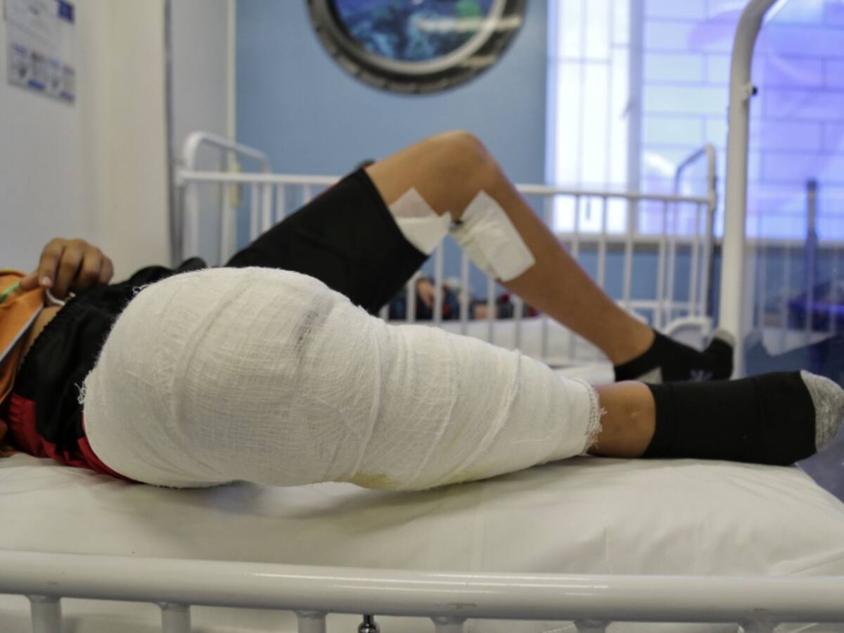 Cinco personas resultaron quemadas con pólvora en la navidad en Bogotá