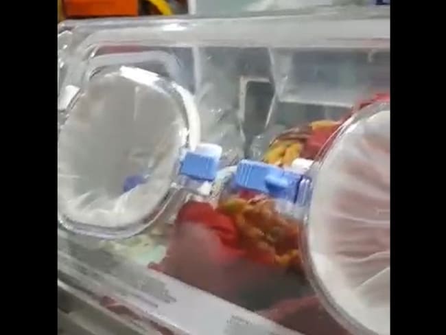Ambulancia en la que era transportada la bebé recién nacida
