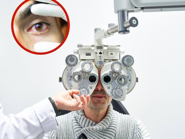 Paciente de oftalmología siendo examinado en un consultorio junto a la imagen de un ojo irritado (Getty Images)