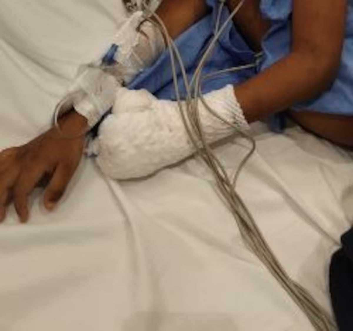 Menor herido. // Colprensa