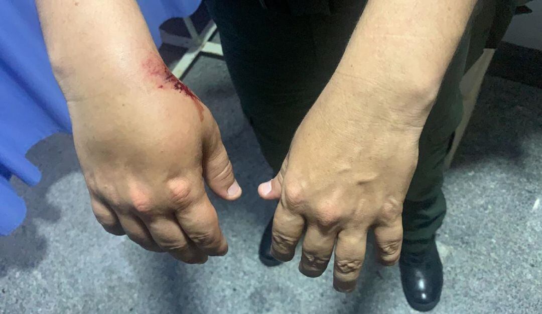 Las autoridades también reportaron la captura de tres personas por el delito de violencia contra servidor público en la Bomba El Amparo