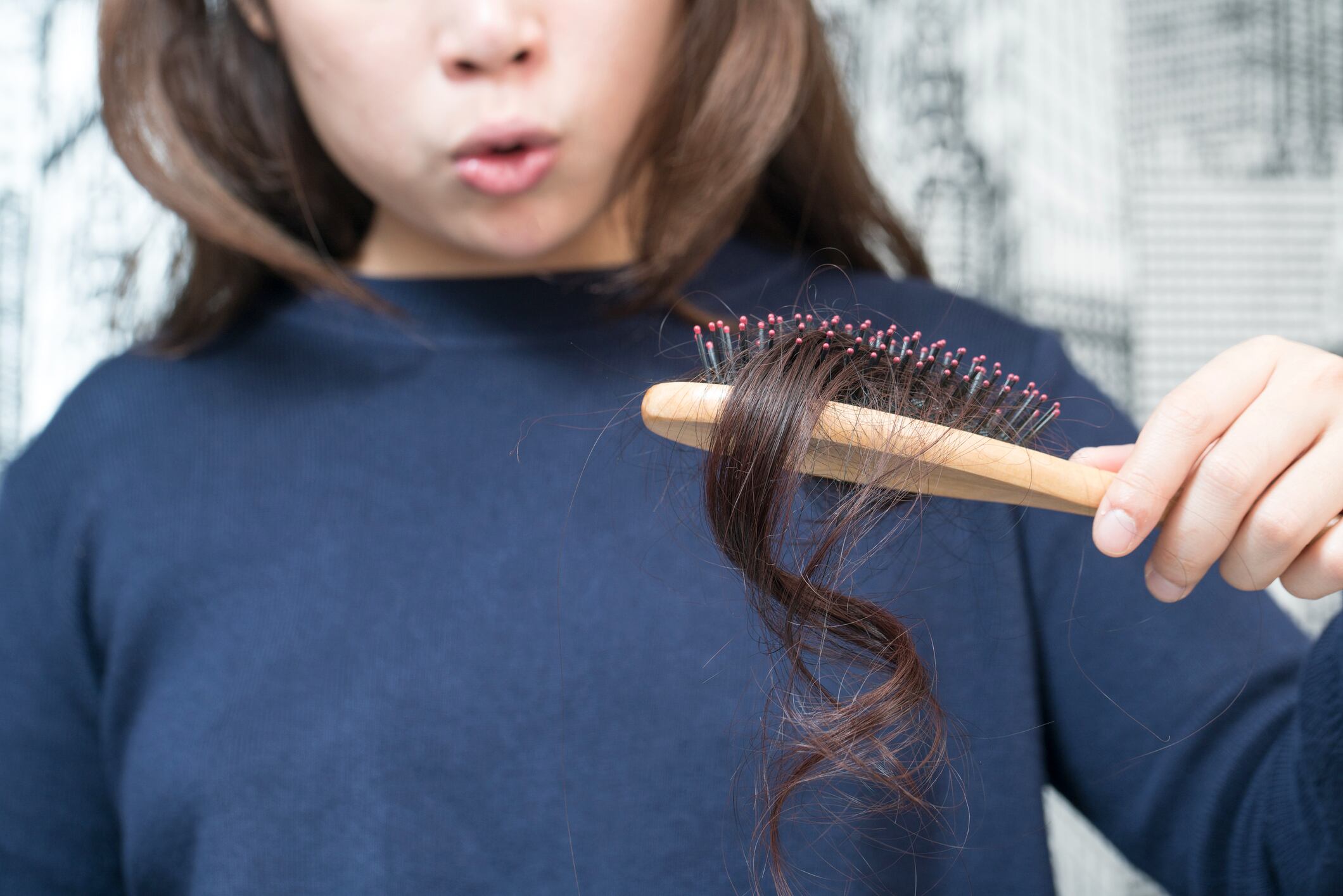 Caída excesiva de cabello podría deberse a la falta de ejercicio físico // Getty Images