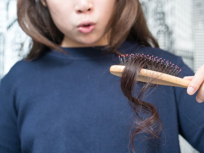 Caída excesiva de cabello podría deberse a la falta de ejercicio físico // Getty Images