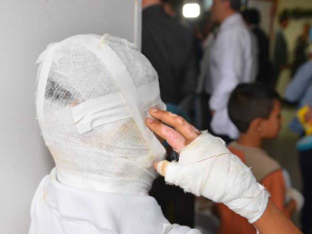 Santos destaca reducción de 53 % quemados con pólvora pero pide mayor compromiso