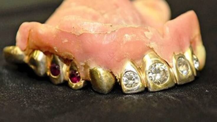 Le roban los dientes de oro a invidente en Antioquia