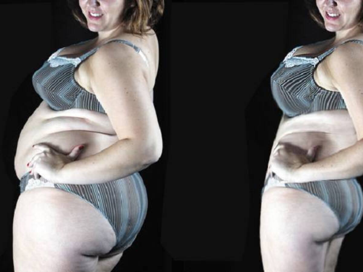 Cuando se quiere se puede: canadiense posa en bikini después de bajar 100 kilos
