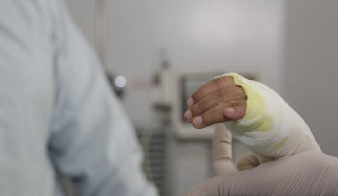 Seis quemados con pólvora en el departamento