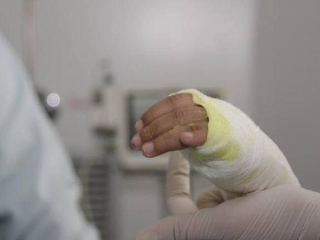 Seis quemados con pólvora en el departamento