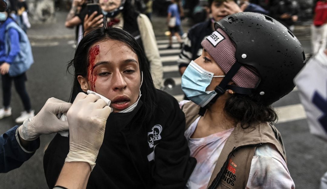 Mujer herida durante paro nacional del 28A