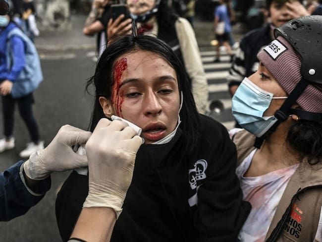 Mujer herida durante paro nacional del 28A