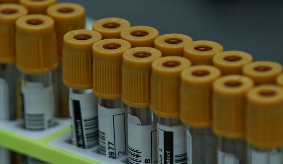 Vacuna contra COVID-19