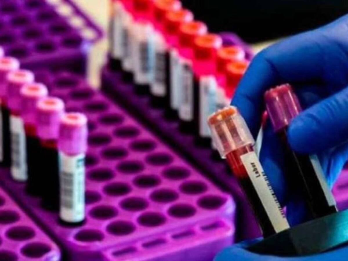 Al menos 150 muestras se han realizado en Pereira para detectar el Covid-19
