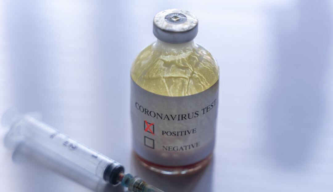 Piden prueba de coronavirus 