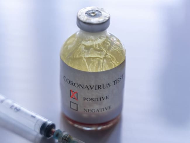 Piden prueba de coronavirus 