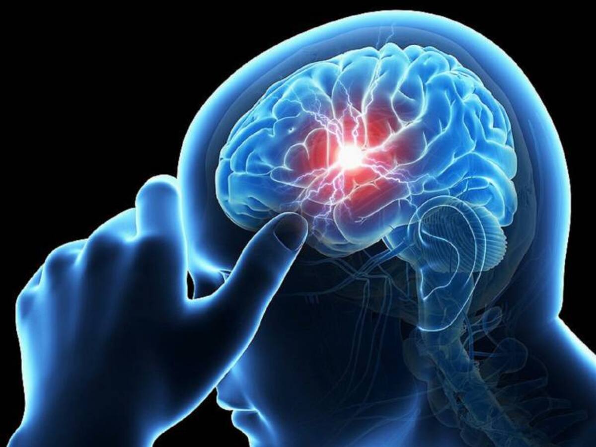 Sistema para mejorar atención médica en Ataques Cerebro Vasculares crean Fundación Valle del Lili e ICESI