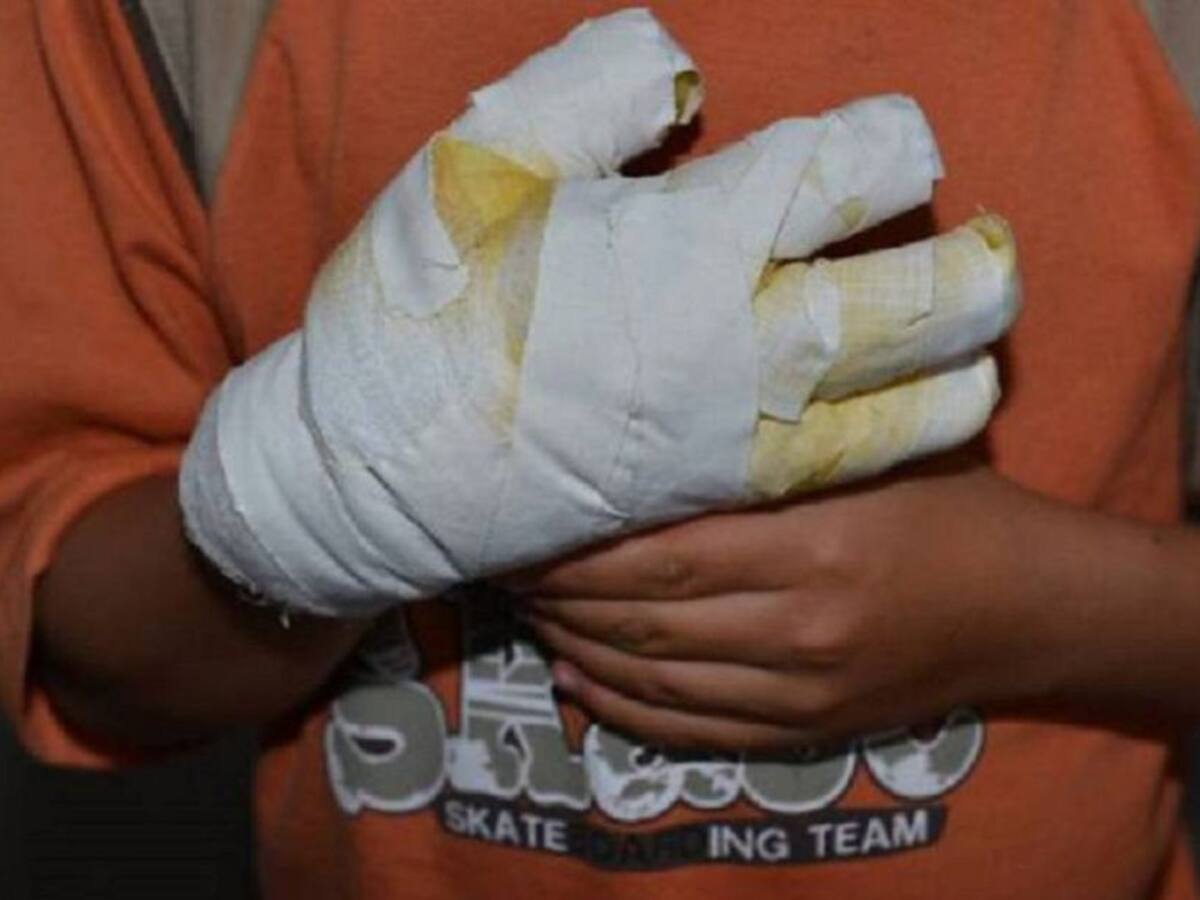 Un niño de 10 años, la nueva víctima de la pólvora