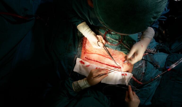 Trasplante de órganos 