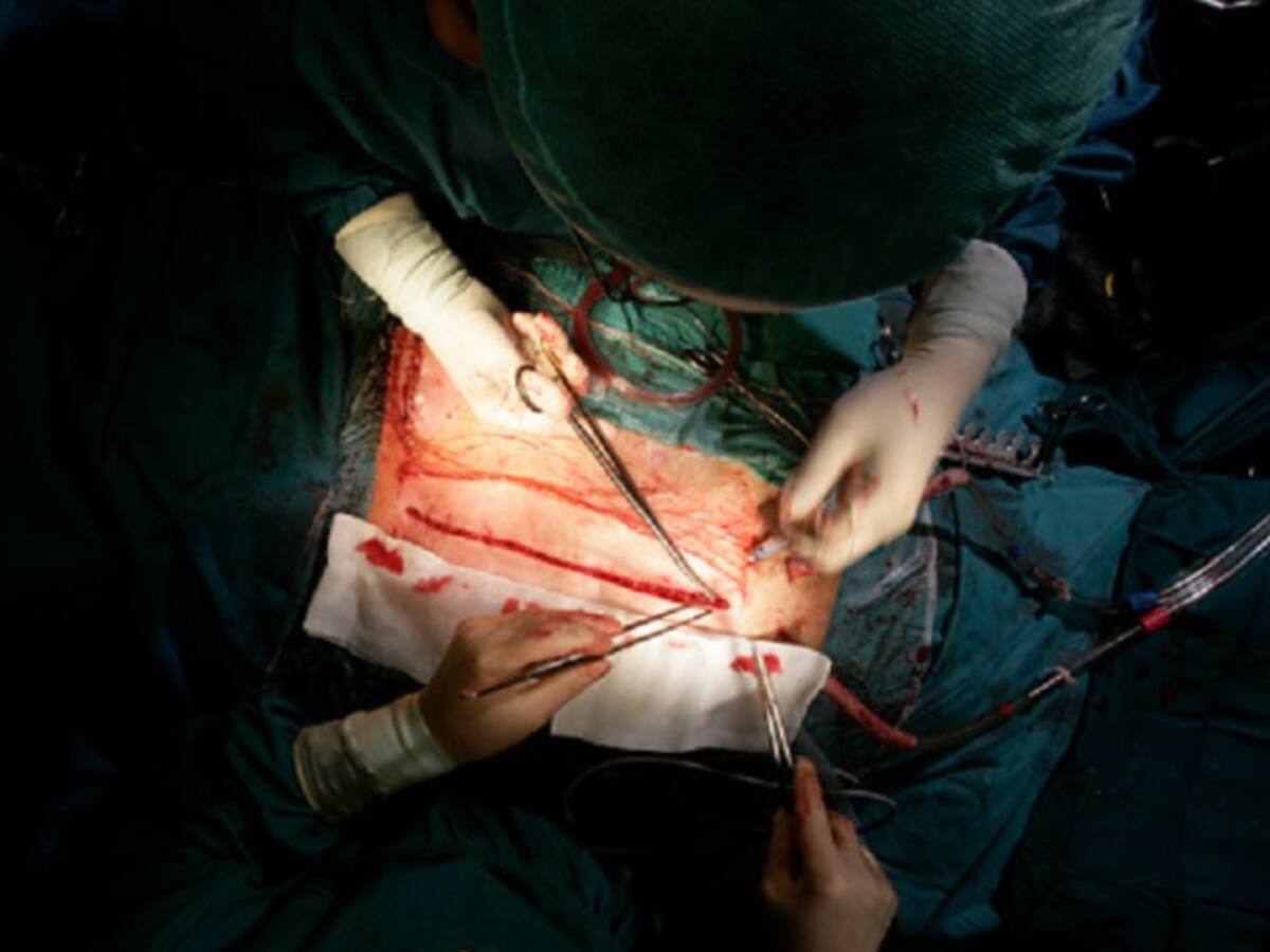 Extraño caso de mujer que donó sus órganos y transmitió cáncer a 4 personas