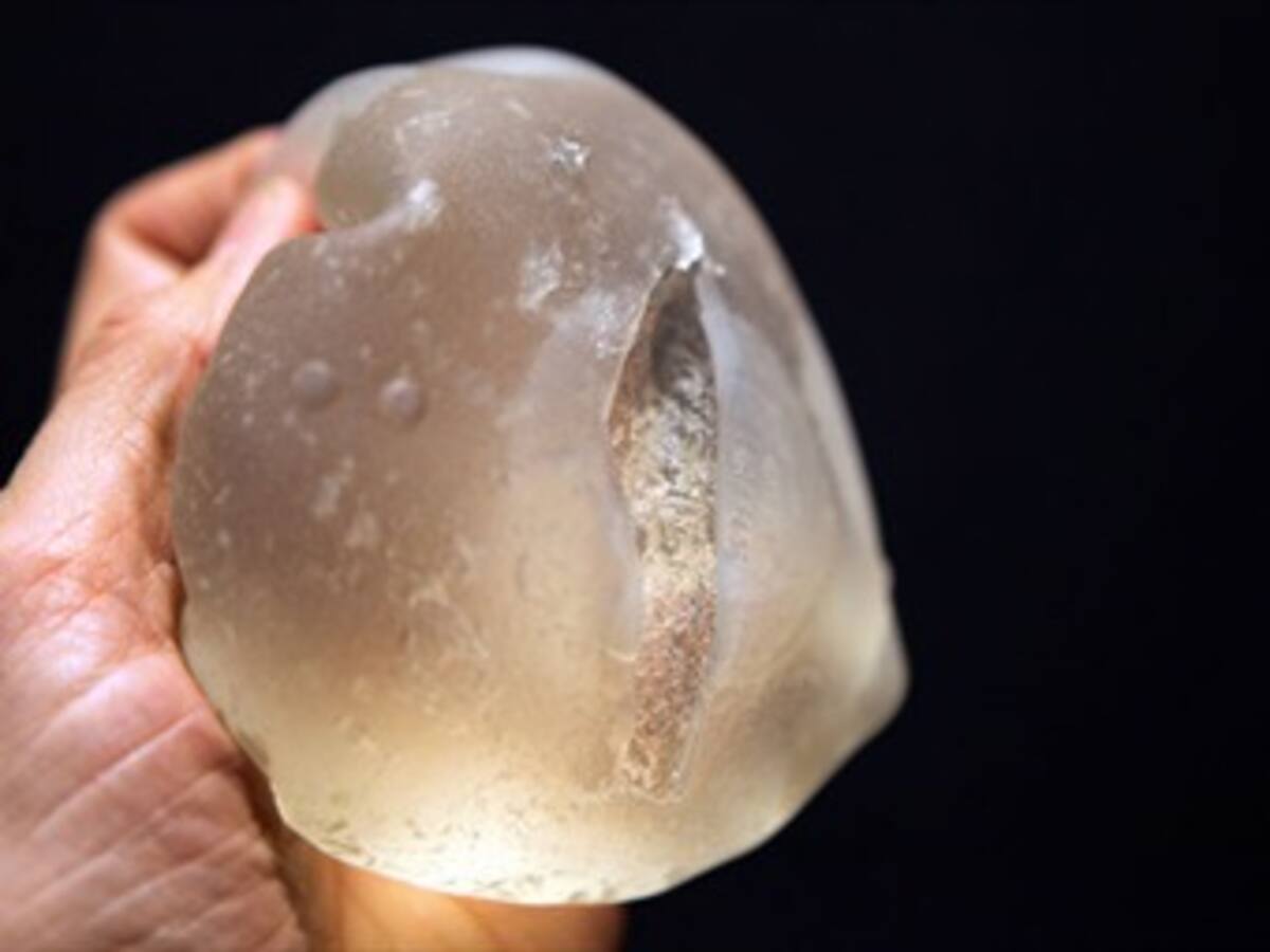 Se cierra el proceso de implantes PIP que afectó a miles de colombianas