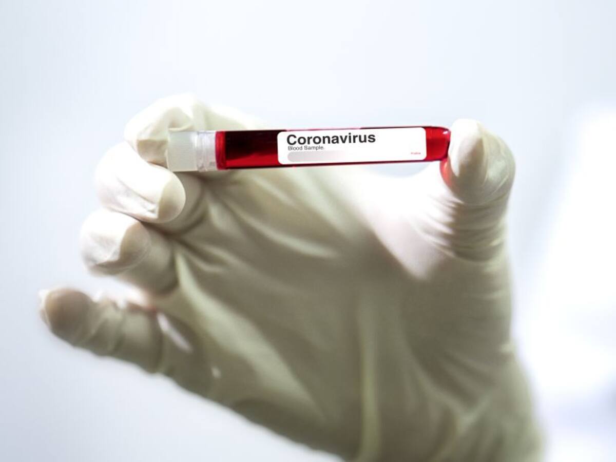 Coronavirus superó las 3.000 muertes y frena la economía mundial