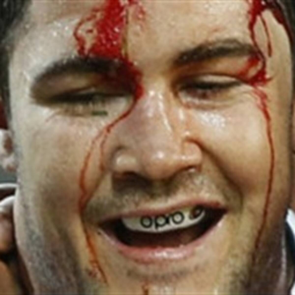 El rugby una demencia temprana