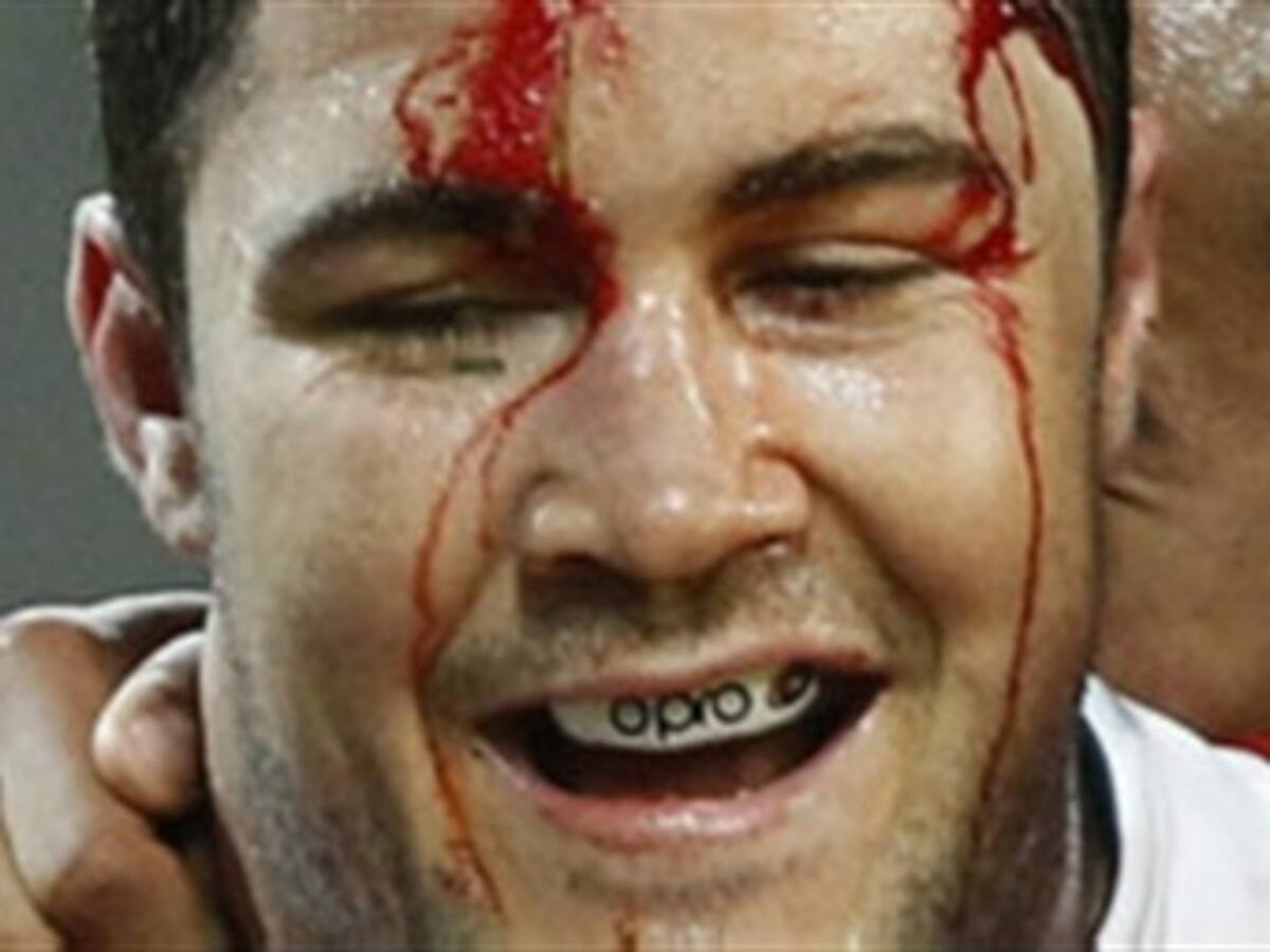 El rugby una demencia temprana