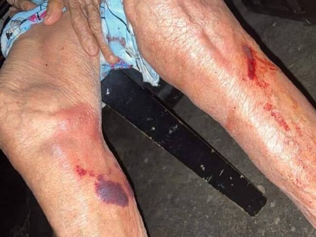 ¡Aberrante! En Santa Marta un hombre agrede físicamente a su abuela