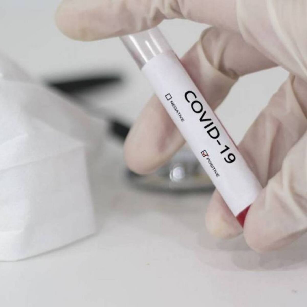 Alertan sobre aumento de casos positivos de COVID-19 en Santa Marta