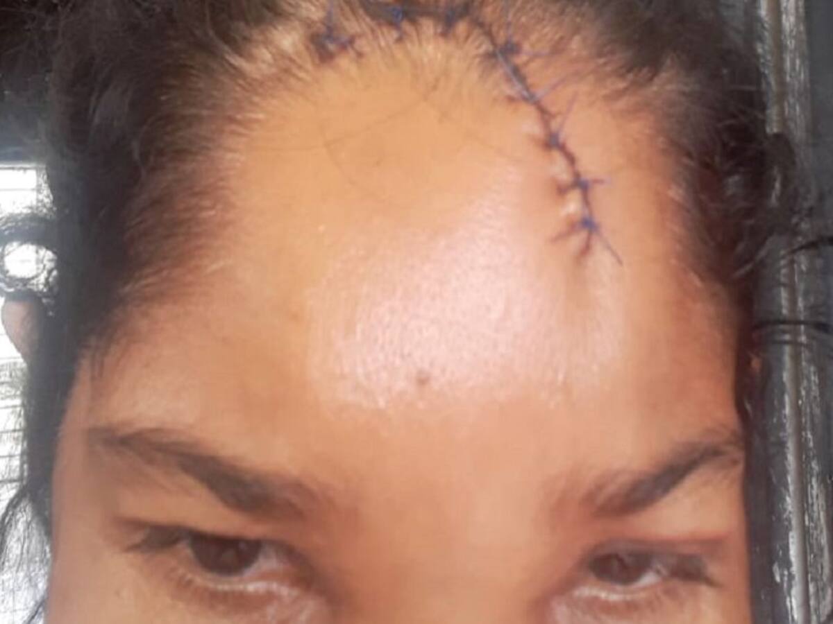 Una mujer en Montería denunció que fue golpeada por un policía del Esmad