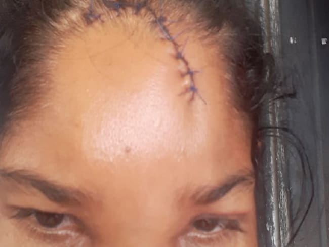 Una mujer en Montería denunció que fue golpeada por un policía del Esmad