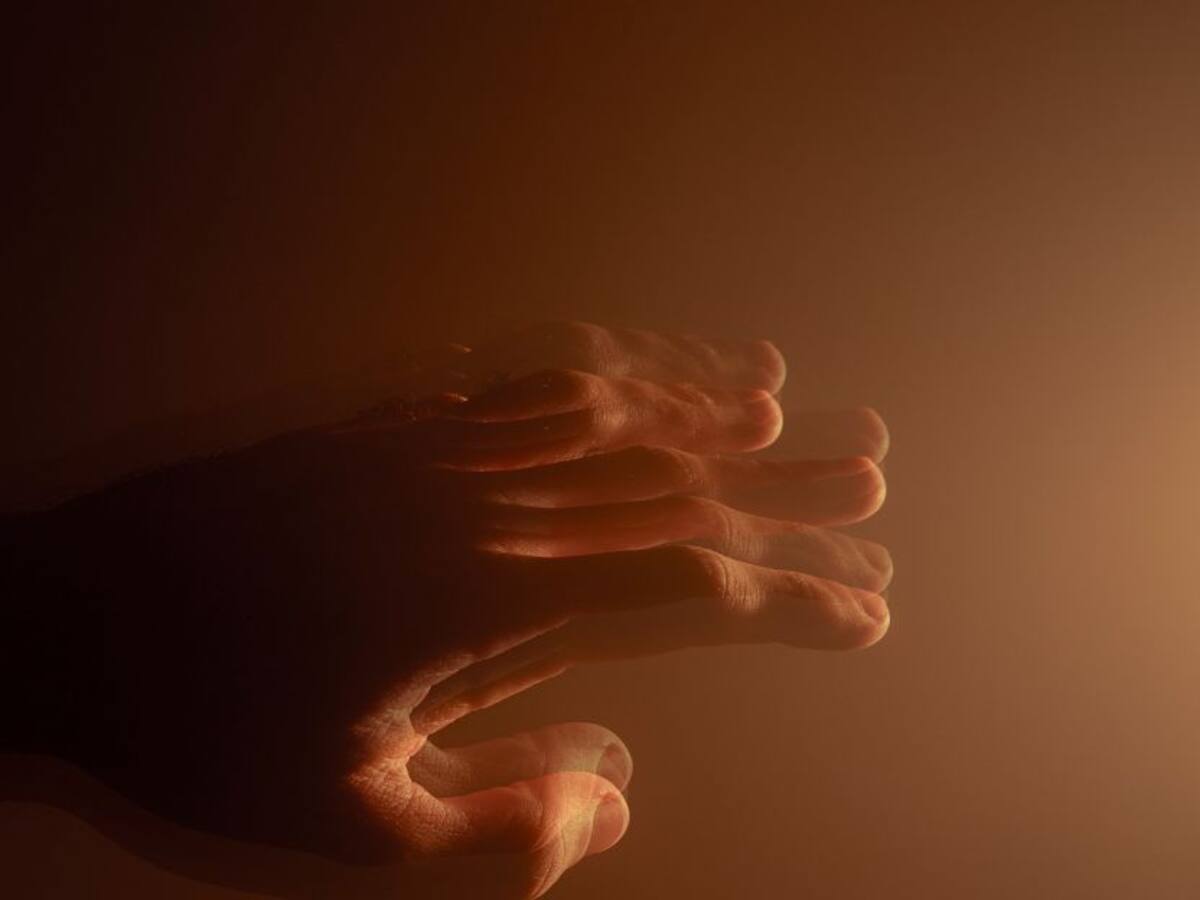 La evolución del Parkinson