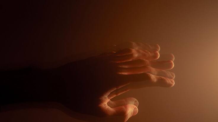 La evolución del Parkinson.