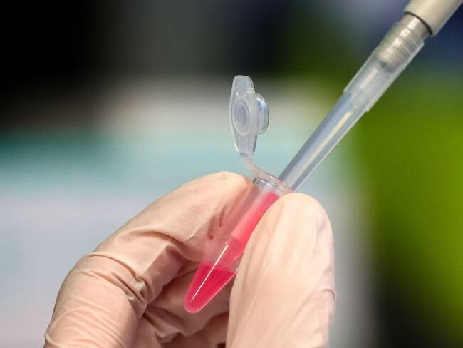 Coronavirus: Oxford ya produce vacunas para venderlas una vez testadas